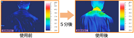 サーモグラフィー